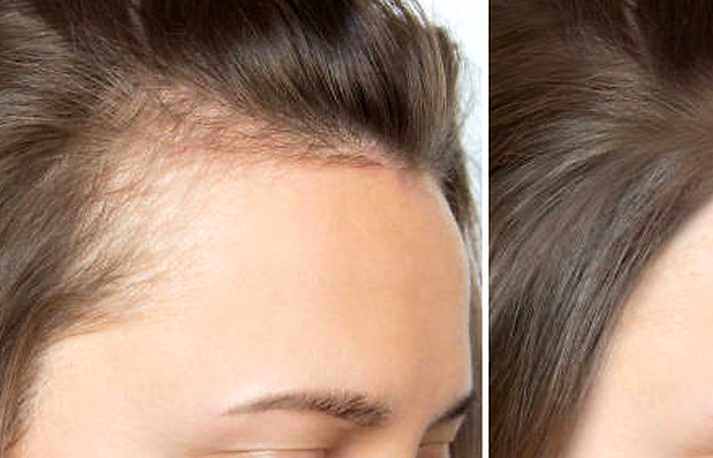 Hair Growth wellness guides